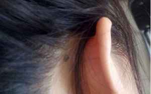 耳朵长痣(耳朵不同位置有痣代表什么含义)