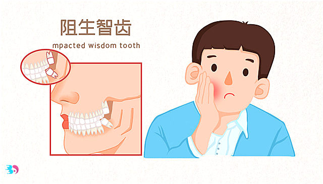 为什么拔牙不能在经期或者牙疼的时候(拔智齿以后要注意)
