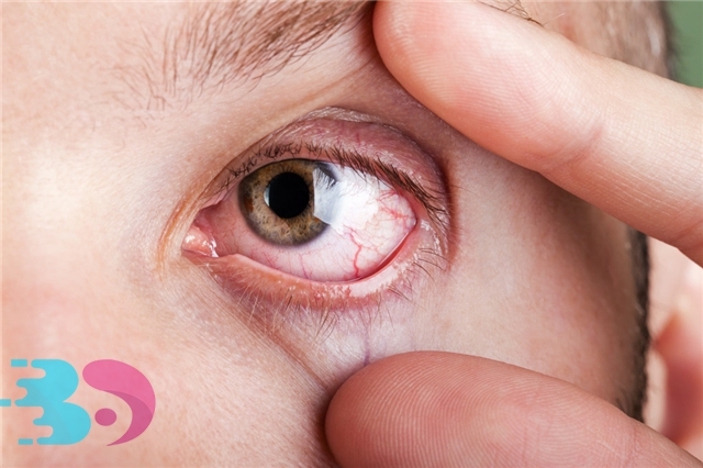视网膜脱落早期症状(视网膜脱落早期症状视网膜为什么会脱落呢)
