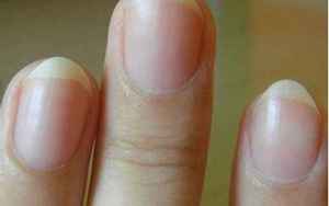手指甲上的月牙代表什么