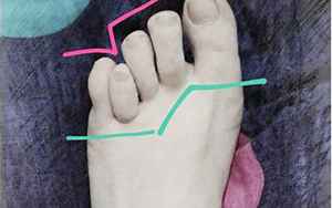 脚趾错位影响什么运势(脚趾的长势与运势)