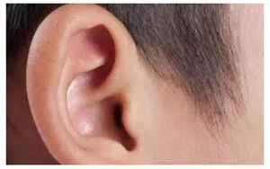 耳热测吉凶预兆(左耳朵发热代表什么预兆)