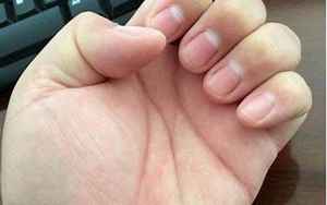 手指上的月牙白代表什么(手指有月牙白代表什么)